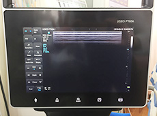 超音波画像観察装置を使用した検査