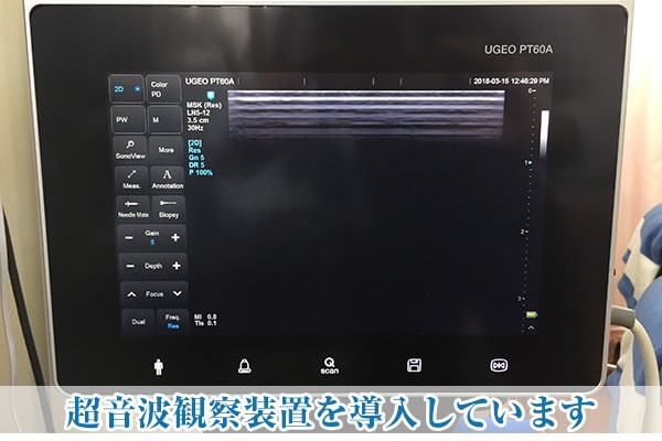 超音波観察装置を導入しています